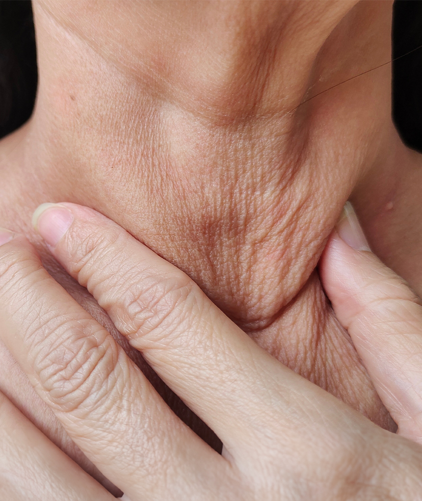 Photo of loose skin on a woman's neck