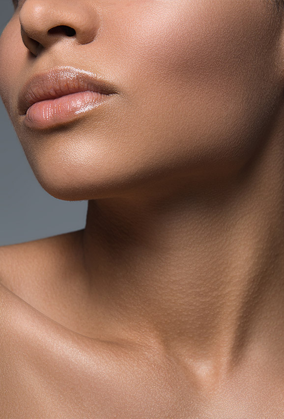 Photo of a woman's lower face and neck area after SkinTyte® treatments