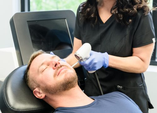 Photo of a man getting ADVATx® treatments at Synergi MedSpa