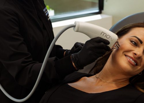 Photo of a woman getting MOXI® treatments at Synergi MedSpa